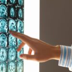 Filing a Claim for a Traumatic Brain Injury from a Car Accident in New York