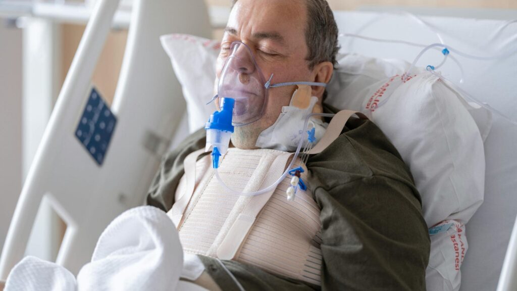 Broken Ribs After an Auto Accident