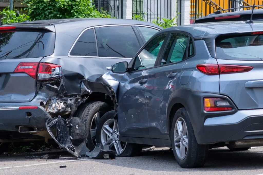 Facial Injuries After a Vehicle Accident