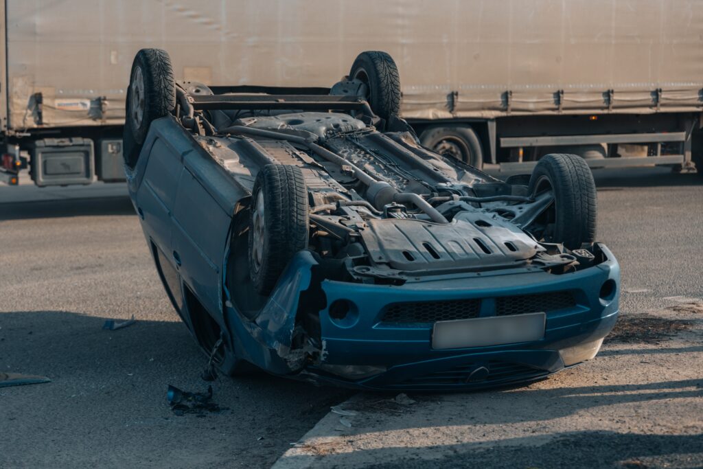 Eye Injuries Caused by Car Accidents