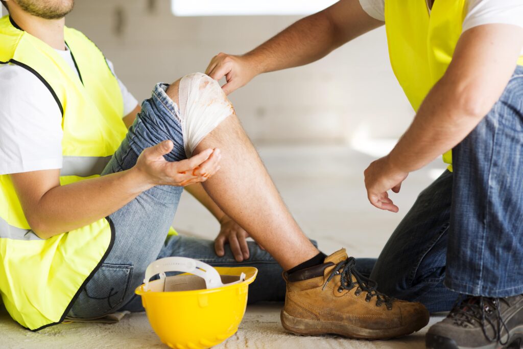 Workplace Burn Injuries for NY Construction Workers