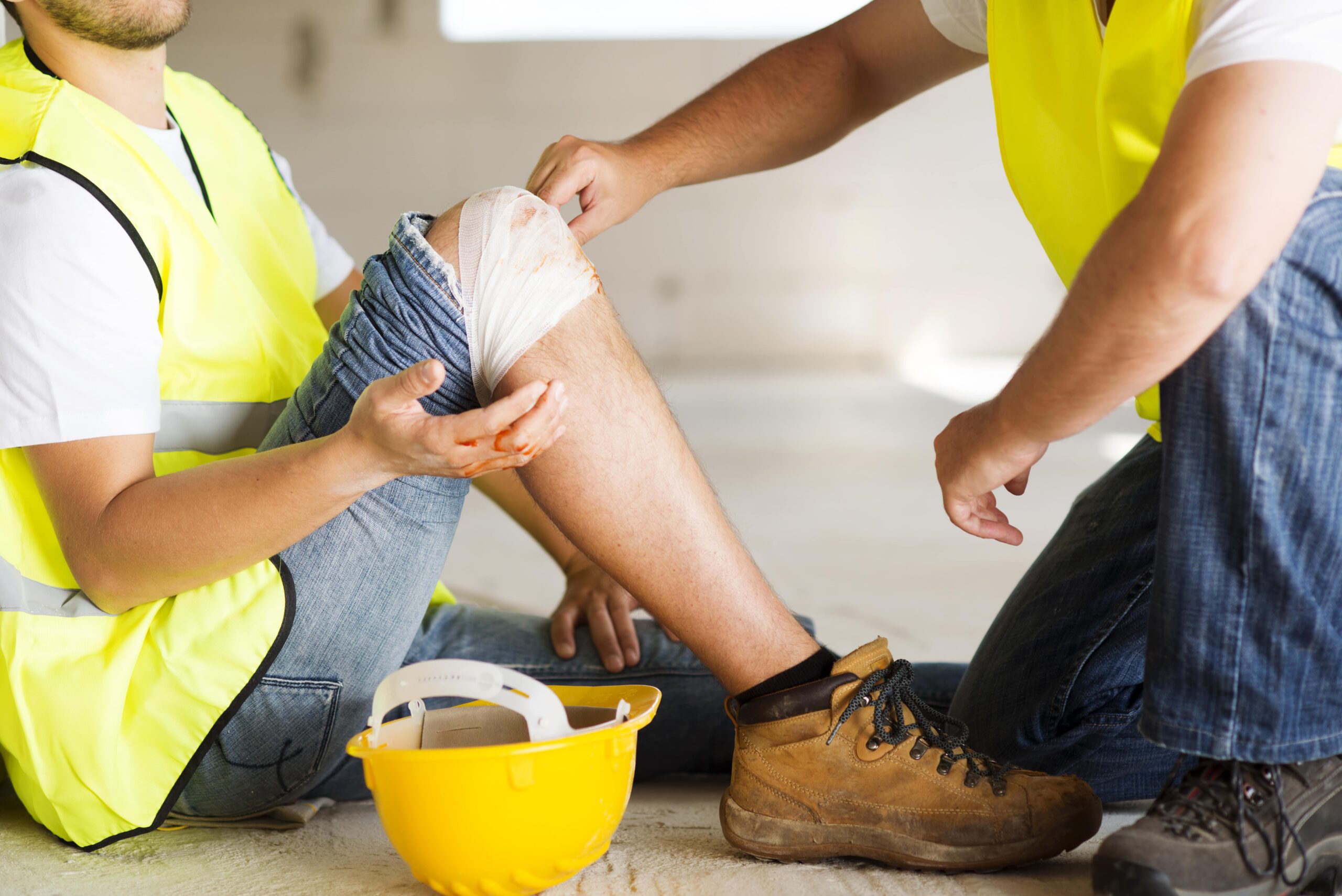 Workplace Burn Injuries for NY Construction Workers